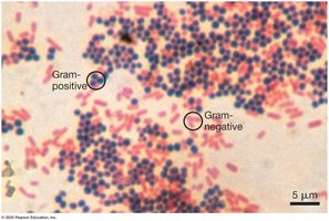 Gram staining distinguishes two types of cell walls