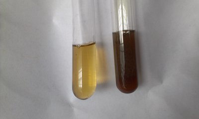 Test tubes showing metabolic differences in alkaptonuria
