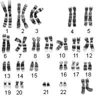 Human karyotype showing chromosomes