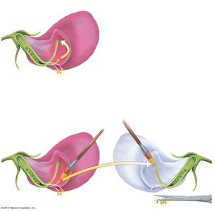 Self-pollination and cross-pollination in pea plants