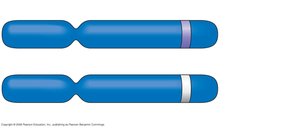 Homologous chromosomes with different alleles at the same locus