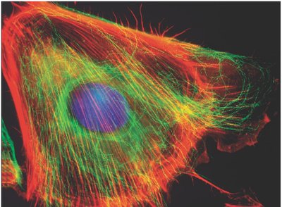 Fluorescent micrograph of cytoskeleton and nucleus