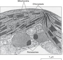 TEM showing peroxisomes, mitochondria, and chloroplasts