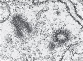 Centrioles and microtubule organization