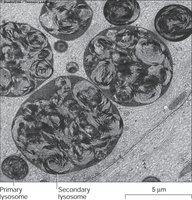 Primary and secondary lysosomes TEM