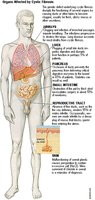 Organs affected by cystic fibrosis