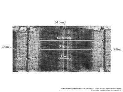 Electron micrograph of sarcomere structure