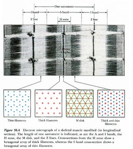Cross-section of sarcomere at different places