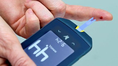 Blood glucose monitoring