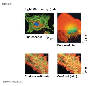Fluorescence and confocal microscopy images