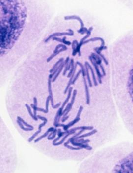 Cell undergoing division with visible chromosomes