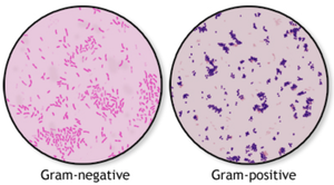 Gram-negative and Gram-positive bacteria under microscope