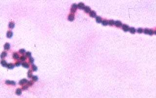 Streptococcus arrangement in chains