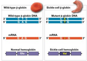Sickle-cell mutation: DNA, mRNA, and protein