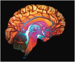 Human brain cross-section