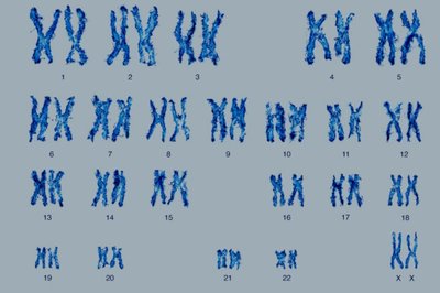 Human karyotype with labeled chromosomes