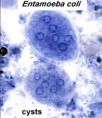 Entamoeba coli cysts