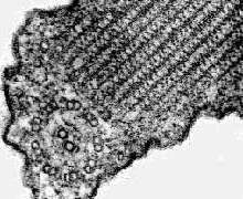 Euglenozoa flagellar structure
