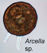 Arcella sp. with test and pseudopods