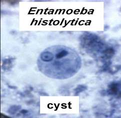 Entamoeba histolytica cyst