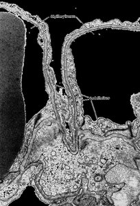 Simple squamous epithelium