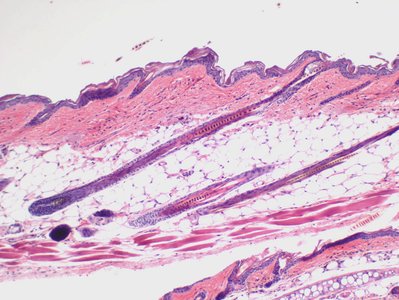 Stratified squamous epithelium