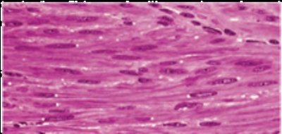 Cardiac muscle tissue