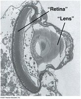 Electron micrograph of a dinoflagellate ocelloid showing lens and retina-like structures