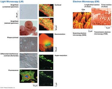 Types of light and electron microscopy