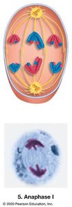 Anaphase I