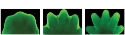 Apoptosis in development of digits