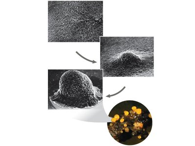 Bacterial aggregation and biofilm formation