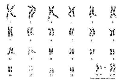 Human karyotype: chromosomes