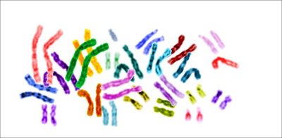 Karyotype showing chromosomes