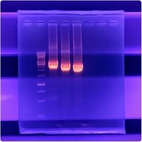 Gel electrophoresis result