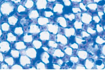 Collenchyma cells in celery petiole