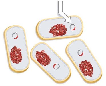 Bacterial transformation with plasmid