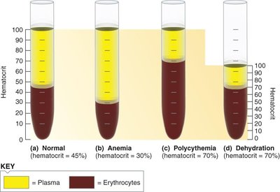 Hematocrit in normal and pathological conditions