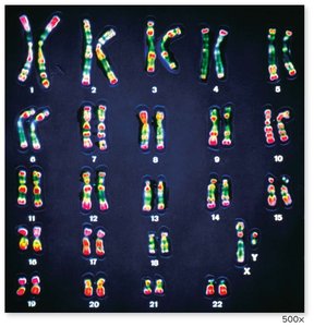 Human karyotype showing 46 chromosomes