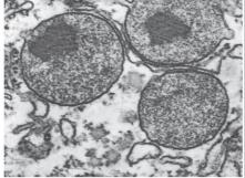 Peroxisome structure
