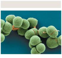 Archaebacteria