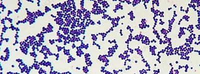 Gram-positive cocci under microscope