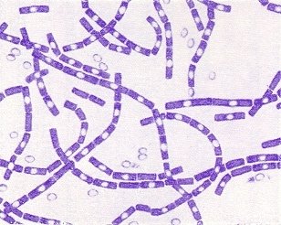 Gram-positive bacilli under microscope