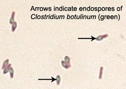 Endospores of Clostridium botulinum
