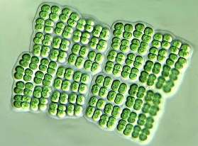 Heterocyst and akinete in cyanobacteria