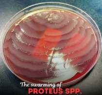 Swarming of Proteus spp. on agar plate