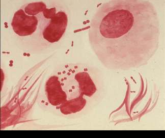 Gram-stained bacteria in clinical sample