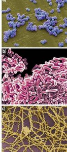 Diagram of bacterial colony shapes and margins