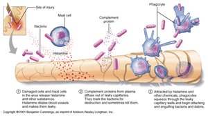 Diagram of inflammatory response sequence