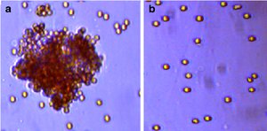 Agglutination of antigens by antibodies